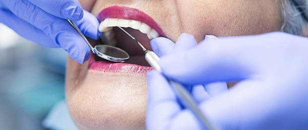 Best Emergency Dentist for Knocked-Out Tooth in Seven Lakes, NC